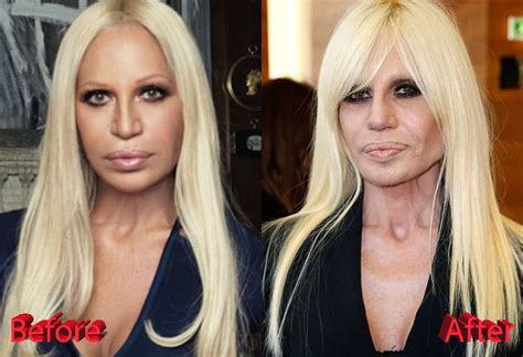 donatella versace interview 2016|donatella versace before and after.